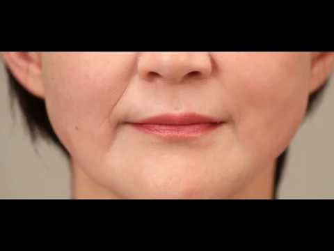 リフトマキシマイザー