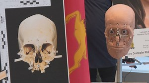 Forensic anthropologist helps with 3 cases of unidentified human remains