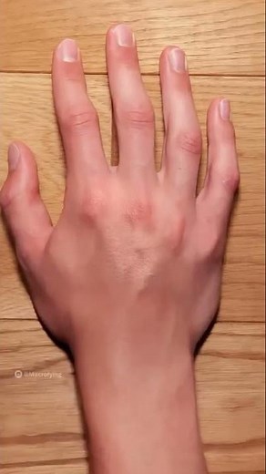 human hand under microscope 😬 ❤️