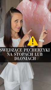 🖐 Małe pęcherzyki na dłoniach lub stopach, które swędzą jak szalone? To może być wyprysk potnicowy – przewlekła egzema która wraca falami i potrafi mocno dać się we znaki 🔎 Jak go rozpoznać? • Pojawiają się drobne, głęboko osadzone pęcherze • Świąd, pieczenie i czasem nawet ból • Skóra się łuszczy i pęka 📌 Co może być przyczyną? • Przewlekły stres • Kontakt z drażniącymi substancjami (np. detergenty, nikiel, lateks) • Skłonności alergiczne, czyli atopia • Nadmierne pocenie i wilgoć 🛠 Jak zła