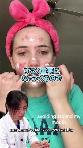 A Girl with Severe Acne! Dr. Takashi Explains Her Skincare Routine