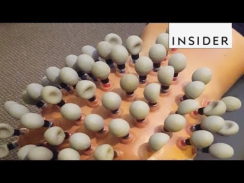 Extreme Cupping Therapy