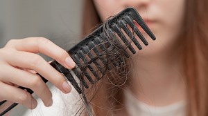 Jakiej witaminy brakuje, gdy wypadają włosy? 10 produktów sprawi, że zahamujesz problem