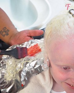 First colorful glimpse after the albino girl's makeover | Fabiosa Life