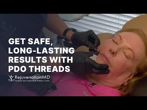 Smooth Upper Lip Lines with PDO Threads