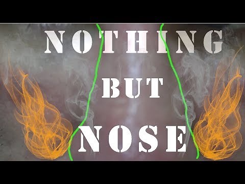 Nothing But Nose | Life With Cystic Acne Documentary #48