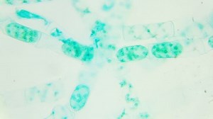 Conjugation Spirogyra Under Microscope Sexual Reproduction: Stockvideos & Filmmaterial (100 % lizenzfrei) 8895631 | Shutterstock