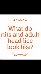 What nits & an adult louse looks like l lice removal service #momlife #hair #piojos #explore | Stacey The Louse Lady