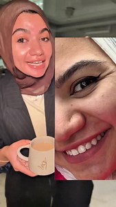 72K views · 828 reactions | Products used @cosrx all in one moisturizer @isntree_ar onion repair cream / hyaluronic acid hel cream @dr.g_official_global red blemish cream / @axisy_mena dark spot correcting cream @dr.altheaglobal 123 cream @purito_official panthenol mighty bambo cream All the korean products you can get from @skinrx__ and use discount code : DrReham | Rehamgaballahh | Facebook