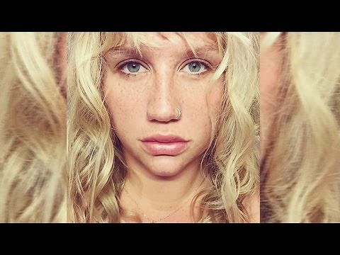 Kesha DROPS Dr. Luke Lawsuit For THIS Reason
