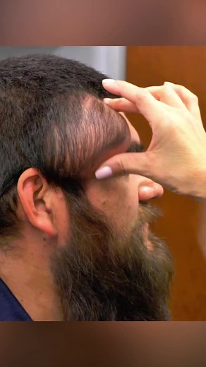 Baseball-Sized Lump on Head: Doctor Lee's Diagnosis Revealed
