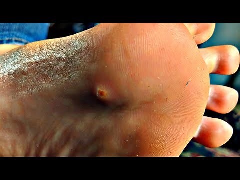 What The Heck Is Prid?