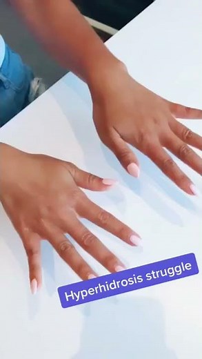 The Struggle of excessive sweating is real (aka hyperhidrosis)
