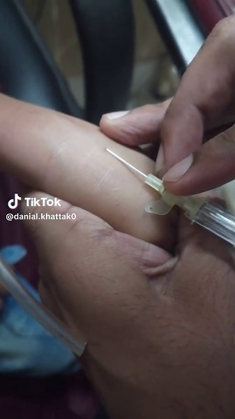 Understanding I/V Line Procedures in Healthcare