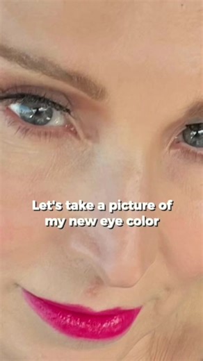 Transform Your Eye Color with Iris Color Laser
