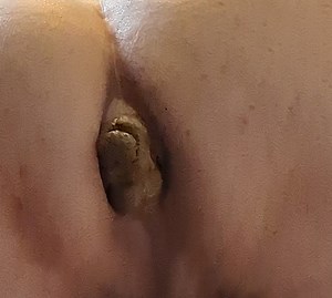 Grunting out several days of hard constipated turds