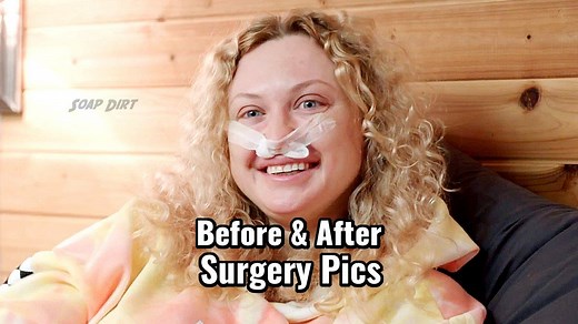 '90 Day Fiance': Natalie Mordovtseva Before & After Surgery Pics