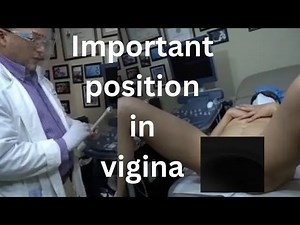 Dr. GUSTAVO IN WHICH POSITION IS THE VAGINA. MOST ELASTIC_ SECOND PART - YTboob