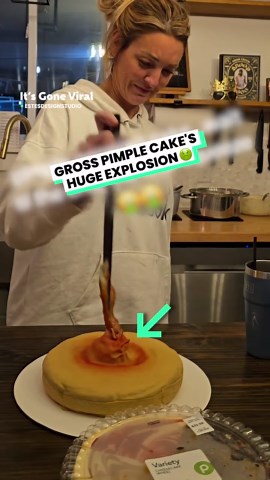 Gross pimple popping birthday cake