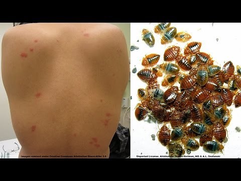 How To Find Out If You Have Bed Bugs Discreetly - Surge Protector Bed Bug Trap Review