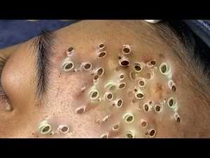 𝐂𝐡𝐢𝐥𝐥 𝐘𝐨𝐮𝐫 𝐋𝐢𝐟𝐞 𝐖𝐢𝐭𝐡 𝐋𝐍𝐆 𝐒𝐤𝐢𝐧 𝐂𝐚𝐫𝐞 # #6164