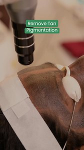 29K views · 510 reactions | ✅Life’s Clinical Skin Lightening treatment helps reduce dark spots, and pigmentation and also promotes brighter healthy skin. Its FDA approved technology provides faster results, which is 4X times better than any products available in the market. Witness the real skin transformation with Life Clinic. Book your consultation now : +91 8019522203 Location: Hyderabad, Vijayawada, Visakhapatnam and Nellore | Life Slimming and Cosmetic Clinic | Facebook