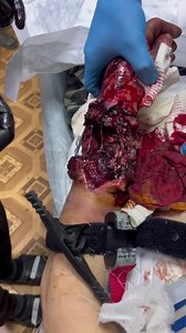 CrazyShit.com | Video from a military hospital. /4.