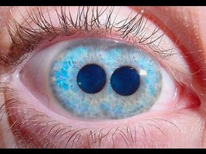 15 Photos of Rare Mutations