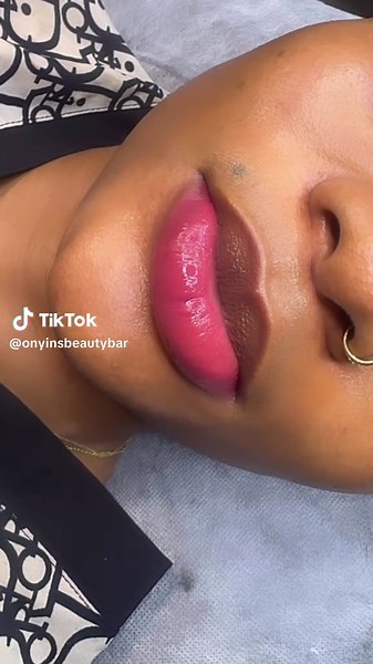 Ultimate Guide to Lip Neutralization Techniques