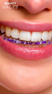 Viral Tooth Gems: Transform Your Smile With Your Retainer! 😁✨ | Beauty Hacks Original