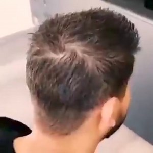 kingyes instant hair thickener spray رذاذ الشعر الطبيعي يزيد كثافة الشعر ويملآ فراغات الشعر يعمل كذلك على اخفاء الشيب خلال ثواني متوفر بثلاث الوان :- الأسود - البني الداكن للرجال والنساء للطلب والاستفسار عالخاص او 📞📞 0790247379 - واتساب 0796060338 https://wa.me/message/LHB75YXE5R4IA1 | Jordan shopping center