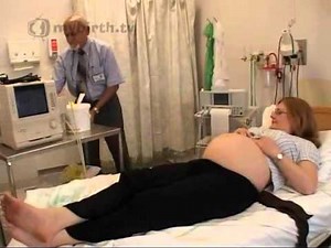 ECV, External Cephalic Version