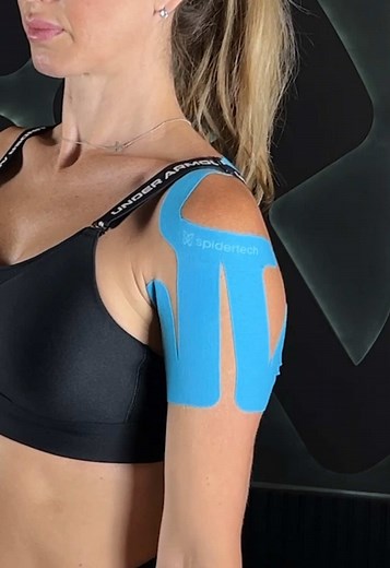 Taping Techniques for Shoulder Impingement Relief