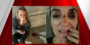 Portland woman says homeless man knocked her unconscious in unprovoked attack