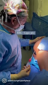 BBL - Lipo 360