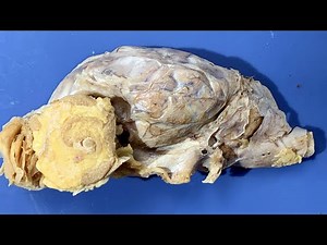 Best Sheep Brain Dissection: Interior Part I (Jr. High, High School and College)