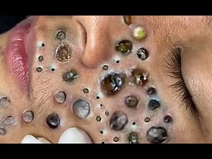 Achieve inner peace with these facial cleansing meth