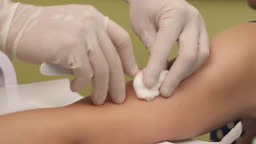 Close-up dokter melakukan drainase hematoma kulit. Konsep medis dan...