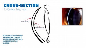 A Simple guide to Slit Lamp Exam and Techniques #Cornea #Eye_Examination | Piece of ophthalmology