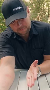 7.2K views · 73 reactions | How bad is the sting from rare Japanese Wasp? #wildlife #nature #bravewilderness #wasp | Mark Vins | Facebook