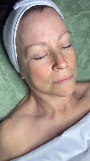 Reveal a younger you! Before and after our age defying facial. Book your appointment today and receive 20% off your first service today!! | Julia Hayes