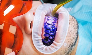 ANTES E DEPOIS IMPRESSIONANTE DE UMA LIMPEZA PROFUNDA DE DENTES! PROTEGENDO DAS CÁRIES! | Agora eu já vi tudo