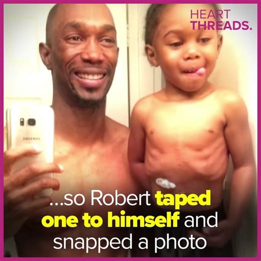 Father-son feeding tube selfie goes viral | HeartThreads