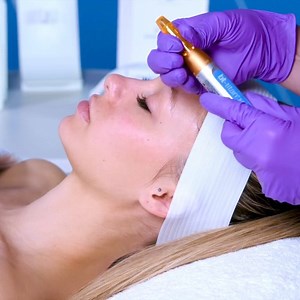 Beautiful technology.🧡✨ Watch the bt-titan microexfoliation in action. Shop 15% OFF at our link in bio. 🛍️ | Bio-Therapeutic