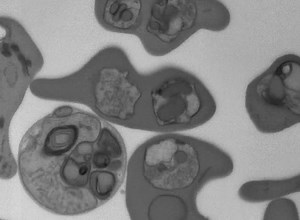 File:Visualizing-the-3D-Architecture-of-Multiple-Erythrocytes-Infected-with-Plasmodium-at-Nanoscale-by-pone.0033445.s001.ogv - Wikimedia Commons