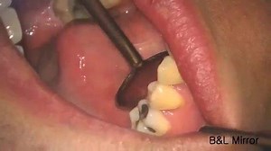 B&L Mirror vs. Regular Mirror Comparison! For more instruction/tutorial videos check out bnlbio.com/pages/videos | B&L Biotech