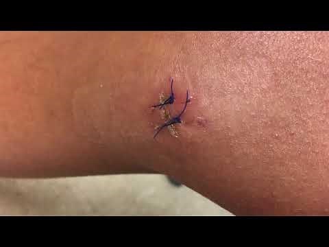 MY 30 DAYS OF GRAPE JUICE FAST RESULTS | DR. MORSE HERBAL PROTOCOL - PART I