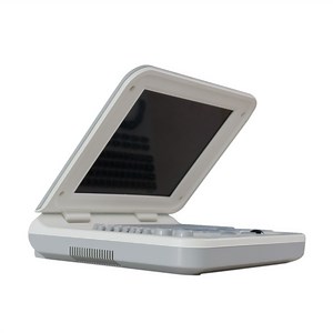 [Hot Item] U10 Mini Portable Laptop Black and White Sonography Equipment