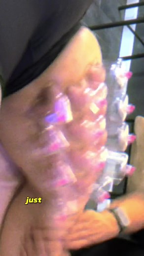 Quads infested with knots that cause this lady to ‘knot’ be able to move her leg! #knot #legs #pain #massage #fascia | Greater Therapeutics