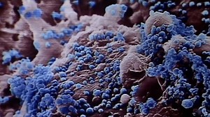 Chasing the bird flu | 60 Minutes Archive - The Global Herald